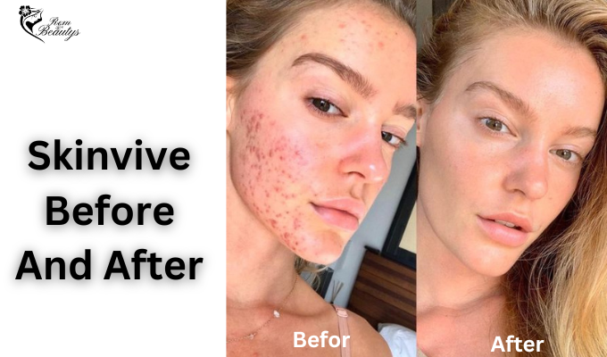 Skinvive Before And After